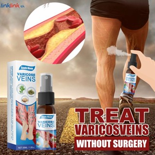 South Moon สเปรย์รักษาเส้นเลือดขอด 30ml Spider Vein Pain Varicosity Cure Vasculitis Varicose Veins Remover For Legs Varicose Veins Remover Linklink