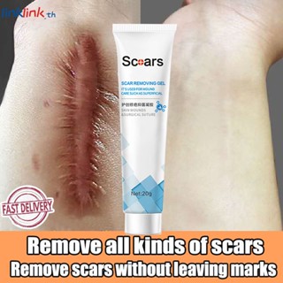 ครีมกำจัดแผลเป็น Jiumutang เจลซ่อมแผลเป็น Dilutes Peklat Remover Acne Treatment Scar Remover Cream Stretch Mark Cream 20g Linklink