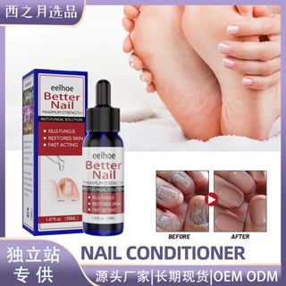 Spot# EELHOE nail repair solution nail care hands and feet Nail Repair Moisturizing cleaning onychomycosis repair solution 8jj