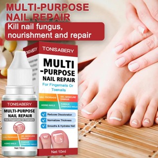 ( TO-02 แดง 10ml ) ฆ่าเชื้อราที่เล็บ กำจัดเชื้อรา Muti Purpose Nail Repair Solution Hand and Foot Care Nourishing Bri...