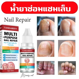 ( TO-02 แดง 10ml ) ฆ่าเชื้อราที่เล็บ เซรั่มบำรุงเล็บ ยาเชื้อราเล็บ ซรั่มรักษาเล็บ เชื้อราเล็บ ครีมบำรุงเล็บ ฆ่าเชื้อร...