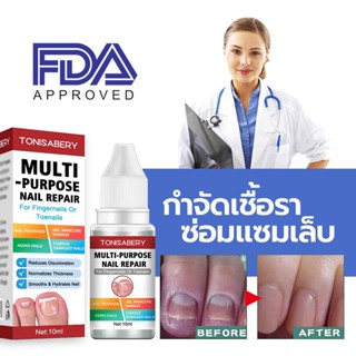 ( TO-02 แดง 10ml ) แก้เชื้อราเล็บ ทาเชื้อราเล็บ เชื้อราที่เล็บ