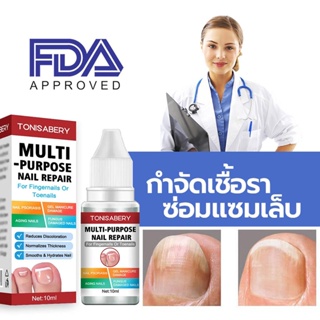 ❤TONISABERY❤ ( TO-02 แดง 10ml ) รักษาเชื้อราที่เล็บ ซ่อมแซมโรคเชื้อราที่เล็บ เซรั่มเล็บ เล็บขบ เซรั่มรักษาเล็บ ยาฆ่าเ...