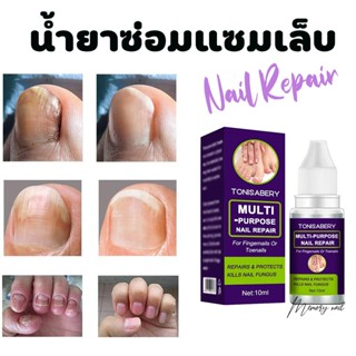 ( TO-03 ม่วง 10ml ) ฆ่าเชื้อราที่เล็บ TONISABERY ซรั่มรักษาเล็บ ซ่อมเล็บที่ชำรุด เชื้อราเล็บ ครีมบำรุงเล็บ น้ำยารักษา...