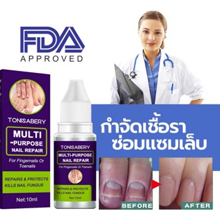 ( TO-03 ม่วง 10ml ) รักษาเชื้อราเล็บ ยาทาเชื้อราเล็บ เชื้อราที่เล็บ รักษาเล็บ เชื้อราที่เล็บ รักษาเล็บขบ ฆ่าเชื้อราที...