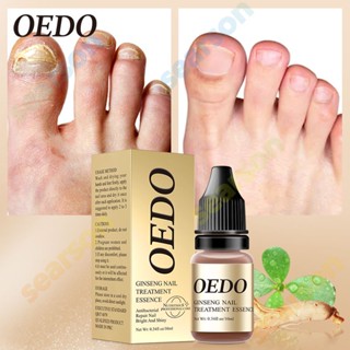 OEDO Antibacterial Ginseng Nail Treatments Essence Nail care repair fluid Remove Onychomycosis Toe Nourishing Brighten Hand Foot Skin Care 10ml 【searson】 【searson】 【searson】