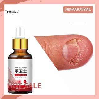 Trd ทรีตเมนต์บํารุงเล็บ ขวดน้ํายา รักษาเชื้อรา เล็บเท้า ต้านเชื้อแบคทีเรีย บรรเทาอาการปวด