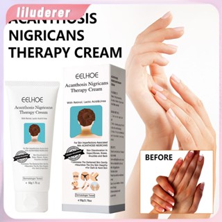 Eelhoe Black Spine Skin Repair Cream Body Whitening Cream Intimate Area Pink Essence Underarm Knee Butt Dullness Brighten Improve Lip Moisturizer Facial Body Care HO