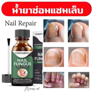 ( TO-04 เขียวใหญ่ 30ml ) ฆ่าเชื้อราที่เล็บ เซรั่มบำรุงเล็บ ยาเชื้อราเล็บ ซรั่มรักษาเล็บ เชื้อราเล็บ ครีมบำรุงเล็บ ฆ่า...