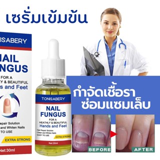 ( TO-05 ขาวใหญ่ 30ml ) รักษาเชื้อราเล็บ ยาทาเชื้อราเล็บ เชื้อราที่เล็บ รักษาเล็บ เชื้อราที่เล็บ รักษาเล็บขบ ฆ่าเชื้อร...