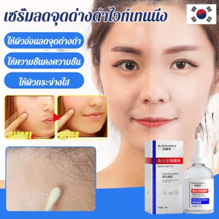 เซรั่มลดจุดด่างดำให้ผิวขาวชุ่มชื้น เซรั่มต่อต้านกระ Essence ฟื้นฟูผิวให้ความชุ่มชื้น