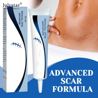 JULYSTAR SOUTH MOON Advanced Scar Formula Fade Scar Stretch Marks Remover Cream Repair Acne Spots Blackhead Whitening Treatment Ointment สารสกัดจากสมุนไพรธรรมชาติ Skin Care 15g