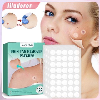 120 ชิ้น/กล่อง Warts Remover Patch ปลอดภัยไม่เจ็บปวดแท็กแพทช์สิว Wart Treatment Patch HO