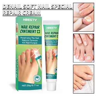 20g Nail Treatment Fungal Nail Repair Cream Care Onychomycosis Nail Ointment