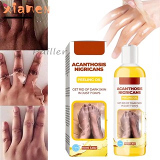 Xianen Acanthosis ไนไตรแคน น้ํามันลอก ดูแลผิว ผิวกระจ่างใส เจลทําความสะอาดผิวที่ตายแล้ว กําจัดผิวที่ตายแล้ว น้ํามันแก้ไขจุดด่างดํา