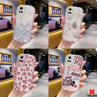 เคส VIVO Y51 Y31 กรณีโทรศัพท์มือถือลายน่ารักครีม TY2