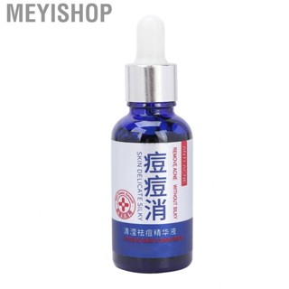 Meyishop Serum  Gentle   Natural Nourishes Skin Facial Face Smooth for Care  Pimple