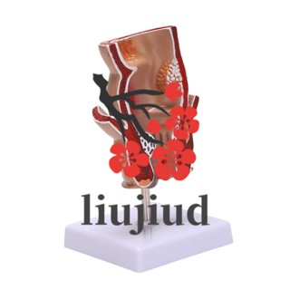Liujiud โมเดลมนุษย์ สมอเรือ จําลองการสอน