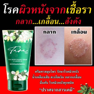 ของแท้ 💯 ครีมทารา 👍ทาแก้อาการคันในร่มผ้า ยาทาสังคัง ครีมทาแก้เชื้อรา ครีมแก้คัน ยาทาเชื้อรา แก้คันผิวหนัง