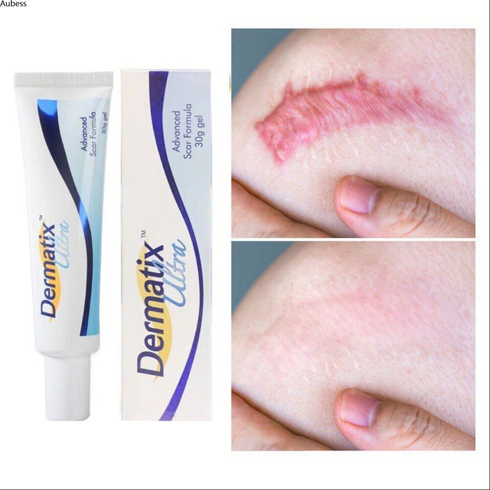 สูตร Dermatix Ultra Advance Scar Cream ลบรอยแผลเป็น (15g) Aube