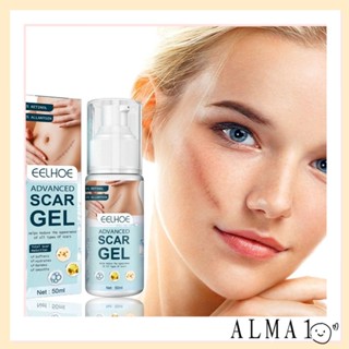 Alma Desalination Scar Gel, ครีมลบรอยแผลเป็นจากสิว, รอยแผลเป็นจากการผ่าตัดที่มีประสิทธิภาพ ผิวหนังแผลเป็นผ่าตัด Hyperplasia Retinol Repair Scar Cream ทุกเพศ