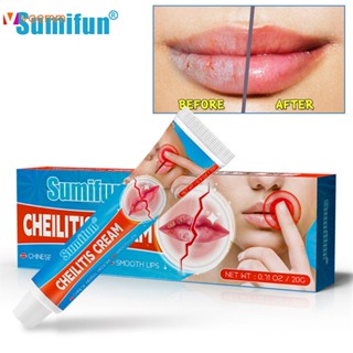 Sumifun 20g Cheilitis Lip Cream แผลเย็น Treatment Anti Lip ริ้วรอยแตก Peeling Repairing Lip Balm LIPS Care Ointment veemm