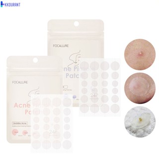 FOCALLURE 24 ชิ้น Acne Pimple Patch ที่มองไม่เห็น Acne Treatment Blemish Patch Mask KDURANT