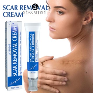 Jaysuing Original Leg Gel Scar Remover หายไปจากรอยไหม้ใหม่และอาการส่าย TECH3