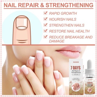 Ouhoe 7 วัน NAIL Repair Essence บรรเทามือเท้า Onychomycosis สดใสนุ่มเล็บ Liquid NAIL Care เซรั่มส่วนผสมธรรมชาติ Body Care 20ml JOYFEEL