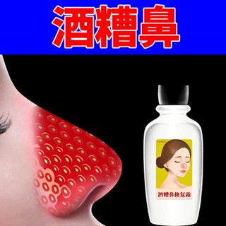 Spot# baishixuan rosacea nose red nose special ointment red bloodshot nose mites both sides red pores large strawberry nose 8jj