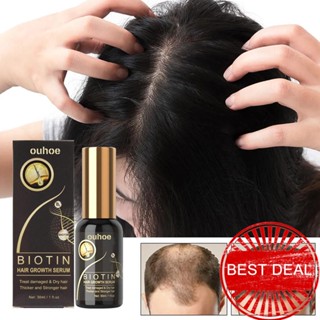 Biotin เซรั่มปั้มผม ป้องกันผมร่วง 30 มล. G5R0