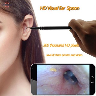 Vip 2 in 1 กล้องส่องทางไกล USB สําหรับตรวจสอบหู จมูก คอ ช่องปาก