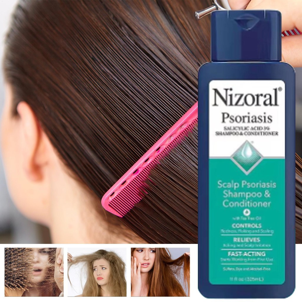 Nizoral Anti Dandruff Itch Relief Conditioner ครีมนวดผมให้ความชุ่มชื้น Hair Care น้ําหนักเบา Conditi