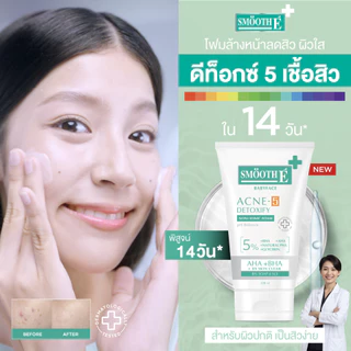 [ใหม่] Smooth E Acne-5 Clean Set เซ็ทดูโอ้จบสิว ทำความสะอาดผิว