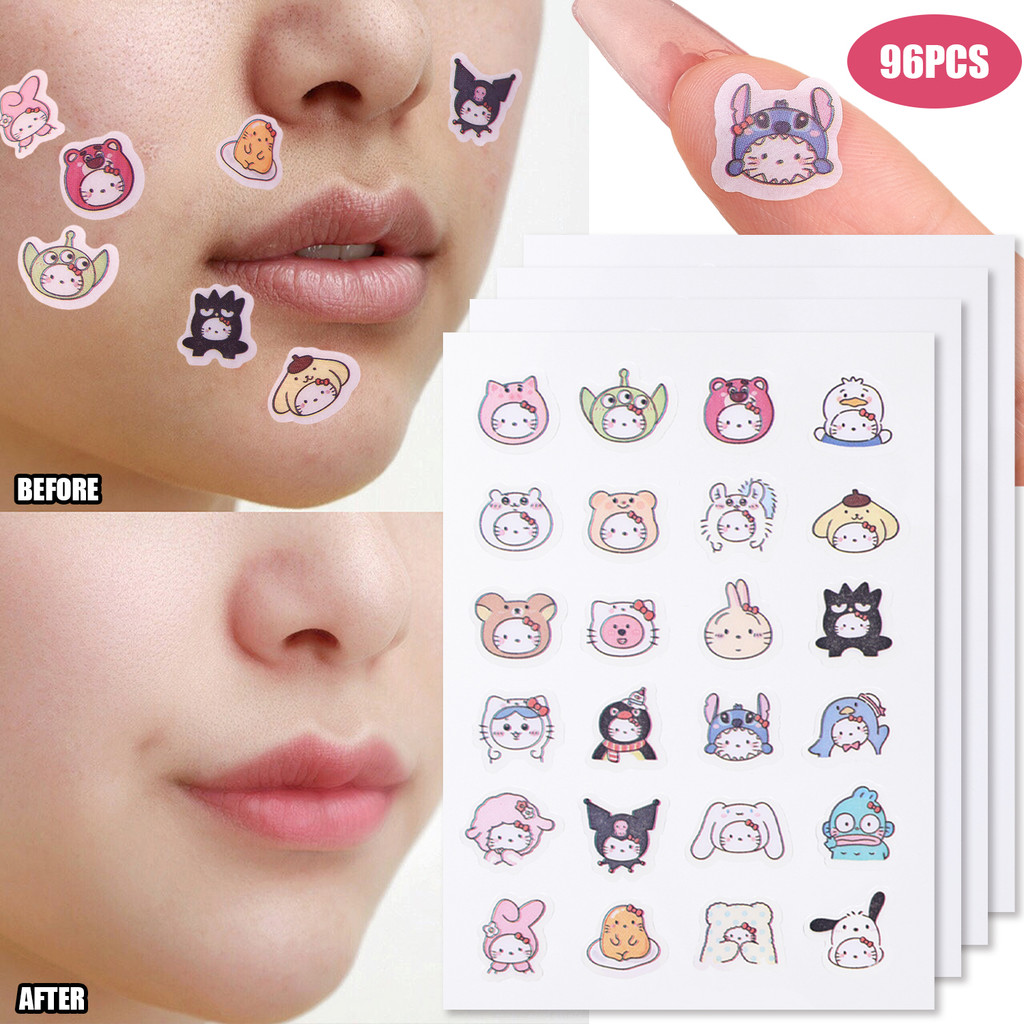 SANRIO 96ชิ้น/แพ็คแผ่นแปะสิวการ์ตูนน่ารัก-สติกเกอร์สีสันสดใสสิวบางเฉียบ-อุปกรณ์ดูแลผิวหน้า-สติกเกอร์สิวซานริโอคิตตี้-มีกาวในตัว,กันน้ํา,ระบายอากา