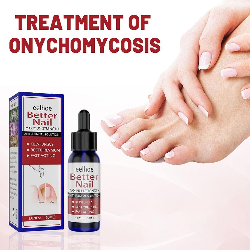 ปลาไหล เล็บ Liquid Care เล็บซ่อมรักษาเล็บ 50ml Care Q6N9