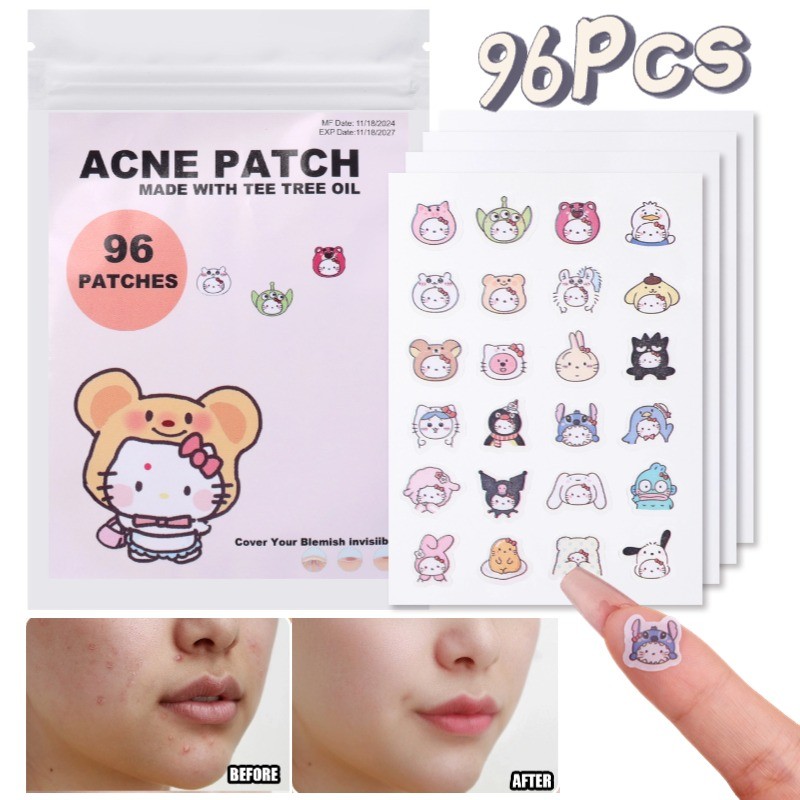 96 ชิ้น Sanrio KT แมวรูปแผ่นแปะสิว Ultra-thin กันน้ํากําจัดสติกเกอร์สิวสําหรับซ่อมแซมผิวบนใบหน้าเครื่องมือความงาม