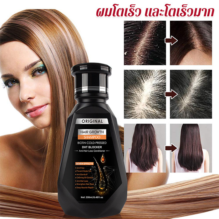 ✨HOT SALE✨แชมพูขิงสำหรับเสริมความแข็งแรงและเพิ่มปริมาณเส้นผม การเจริญเติบโตของเส้นผม สูตรพืชธรรมชาติ