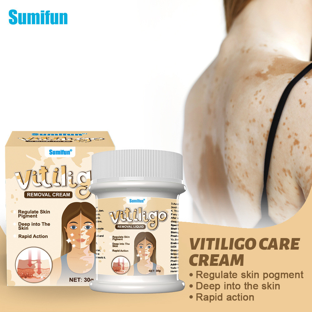 Sumifun External White Spot White Palace Style White Spot Clean jz705t1