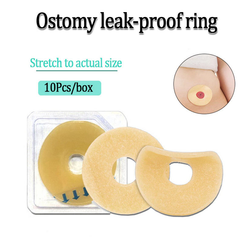 10 ชิ้นแหวนแพทช์ป้องกันการรั่ว Colostomy สําหรับกระเป๋าป้องกันการรั่วไหลและมั่นใจความสะดวกสบายในระหว่างสวมใส่