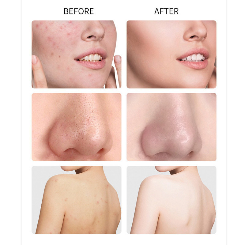 สบู่น้ำนมข้าว สบู่น้ำนมข้าวผสมไข่มุก แท้ 100 % ล้างหน้า/ถูกตัว ใช้ดีสุดๆ พร้อมส่ง - รูปที่ 4