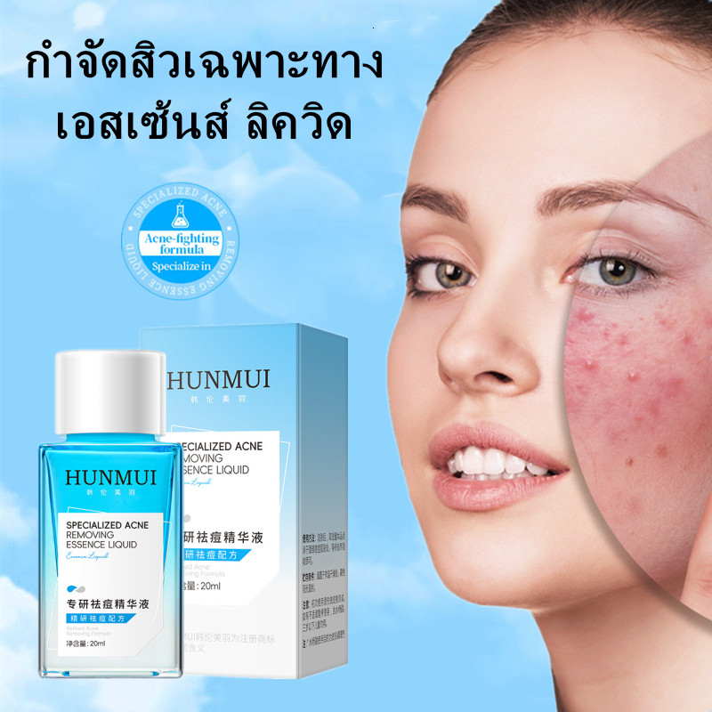 Hunmui เซรั่มกำจัดสิว Salicylic Acid ลดรอยแผลเป็นจากสิวบนใบหน้าอ่อนโยนไม่ระคายเคืองรูขุมขนหดตัวเซรั่