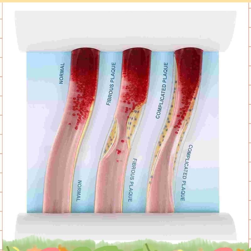 ซูเปอร์ไดนามิกเลือดเรือรุ่นโรคหลอดเลือดสมองบล็อกเสียงคมชัดรุ่นทรอมโบซิสรุ่นสําหรับการเรียนการสอนคําอธิบาย