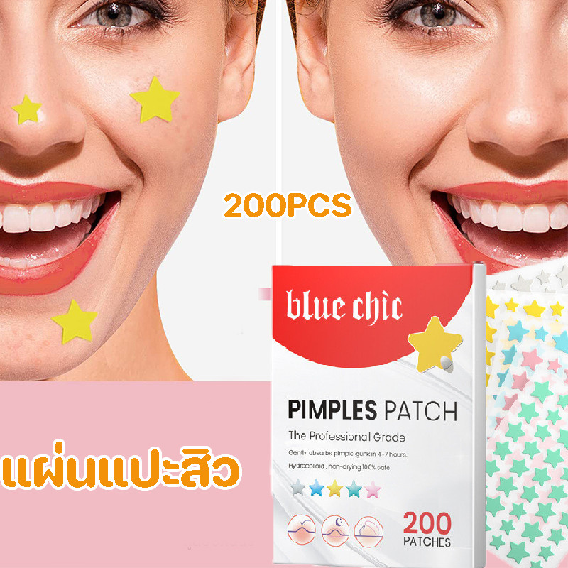 COD  แผ่นแปะสิว 200 ชิ้น  รูปดาว หัวใจน่ารัก อ่อนโยน ดูดสิวเร็ว ซึมซับสิวอย่างอ่อนโยน