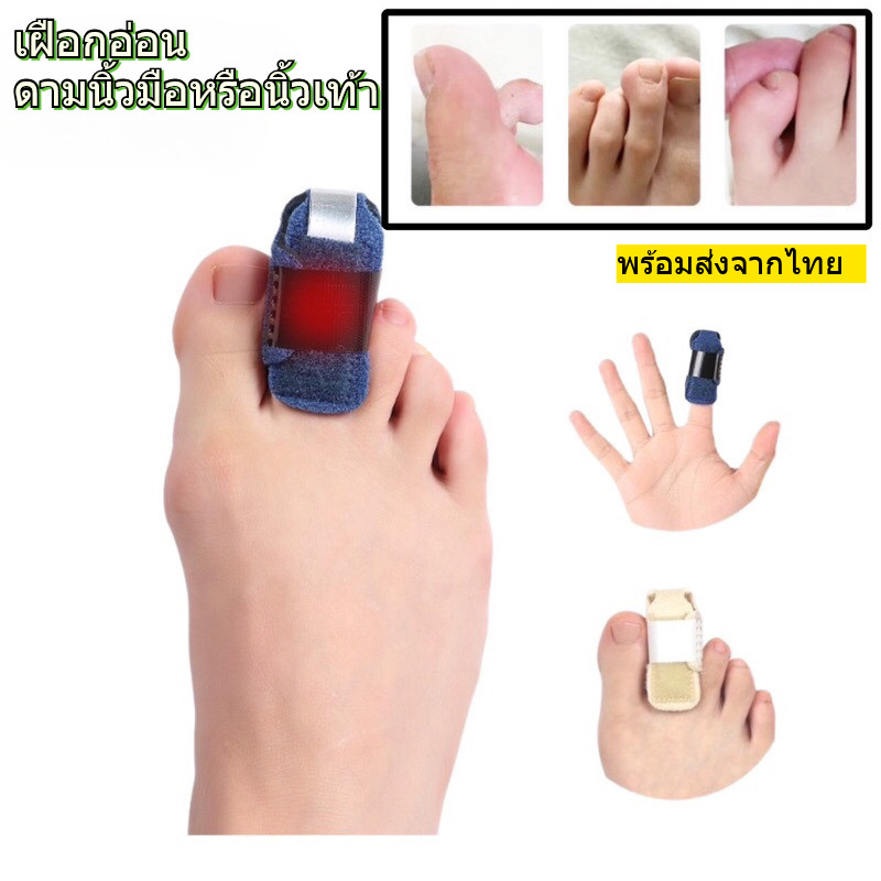 เฝือกอ่อนสำหรับดามนิ้วมือหรือนิ้วเท้า แบบมีเหล็กด้านในถอดได้ ด้าม1นิ้ว มี2สี ครีม ฟ้า สามารถงอปรับได้ พร้อมส่งจากไทย