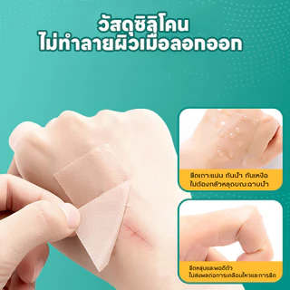 พร้อมส่ง แผ่นแปะแผลเป็น ผิวสวย ดูแลผิว กันน้ำ 4cm*150cm ทำให้รอยแผลเป็นจางลง ลบรอยแผลเป็นแผลผ่าตัด