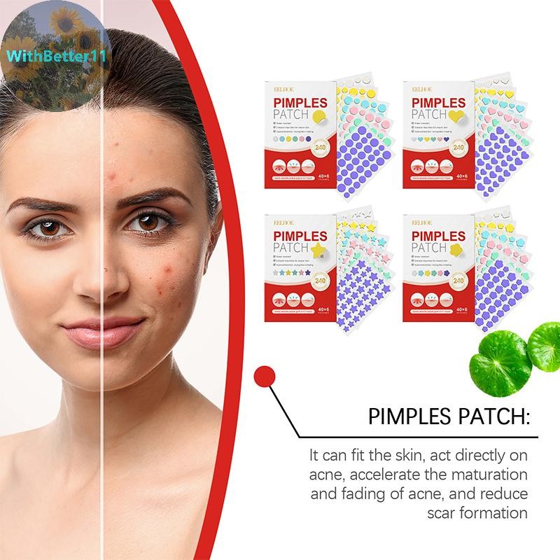 Better 240pcs Salicylic Acid Acne PatchStar Pimple Patch สิวที่มีสีสันที่มองไม่เห็น Skin Care สติกเก