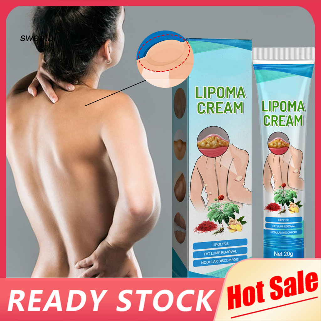 SWE 20g Fatty Lump Cream ไม่เจ็บปวดไม่ปิดกั้นการเจาะอย่างต่อเนื่อง Resolve Subcutativeal Lump-Free Lipoma Removal Cream for Body