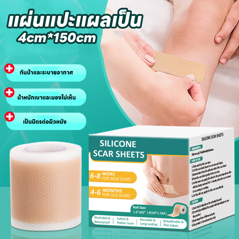 พร้อมส่ง แผ่นแปะแผลเป็น ผิวสวย ดูแลผิว กันน้ำ 4cm*150cm ทำให้รอยแผลเป็นจางลง ลบรอยแผลเป็นแผลผ่าตัด