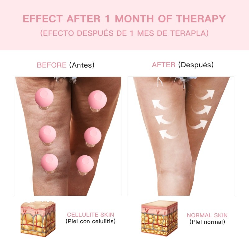 4 ชิ้น/เซ็ตซิลิโคนสูญญากาศ Cupping ถ้วย Facial Lifting Slimming Anti-Wrinkle นวด Anti Cellulite V Face Shaping Beauty Massager - รูปที่ 5